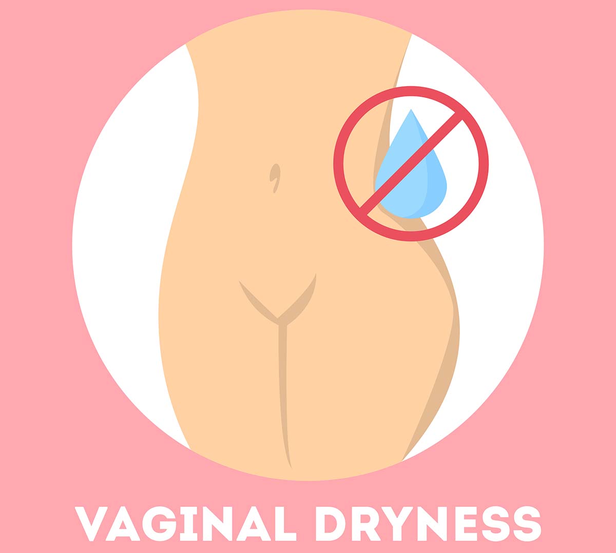 Vaginal Dryness After Menopause