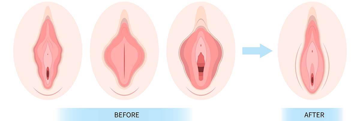 How to Reduce Pain During Sex in Females