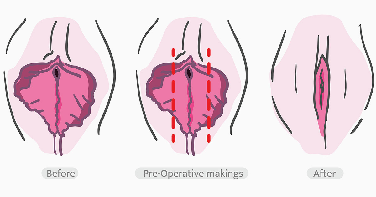 Medical and Functional Considerations